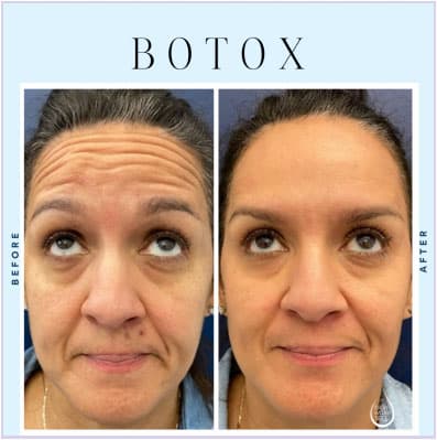 Cosmetic Injectables